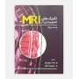 تکنیک های تصویربرداری در MRI بروک