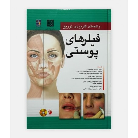 راهنمای کاربردی تزريق فيلرهای پوستی