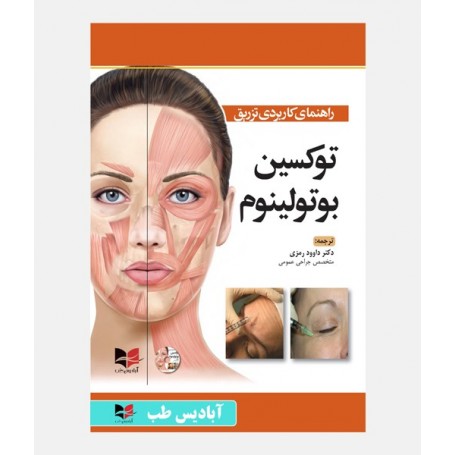 راهنمای کاربردی تزریق توکسین بوتولینوم