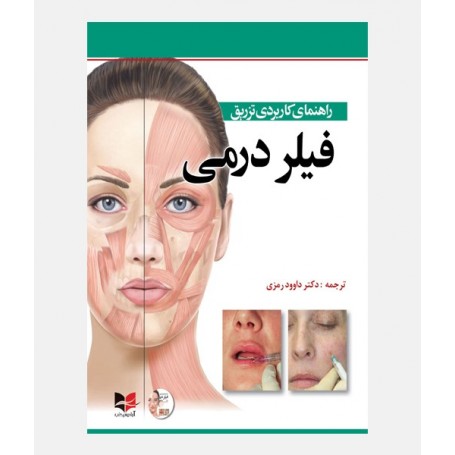 راهنمای کاربردی تزریق فیلر درمی